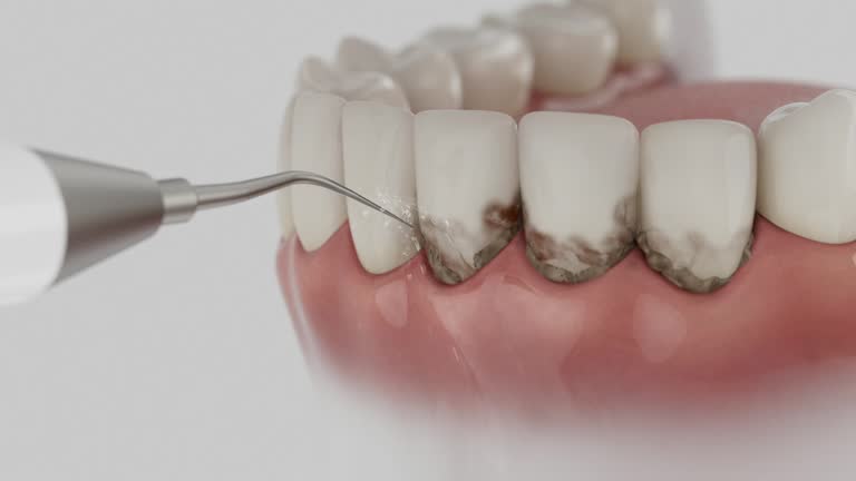 Reliable Dental contractor in Maxwell, CA by Smile Center Dentistry